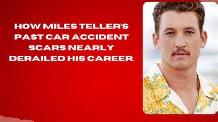 Miles Teller's Scars: The Inside Story Behind His Facial Markings