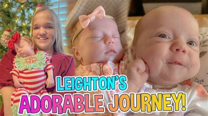 The Adorable Little Johnston Baby Dwarf: A Heartwarming Journey