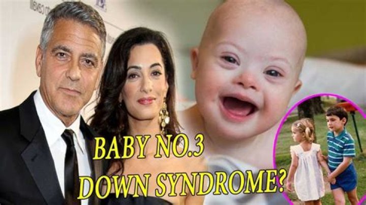 Uncovering The Truth: George Clooney's Twins And Down Syndrome